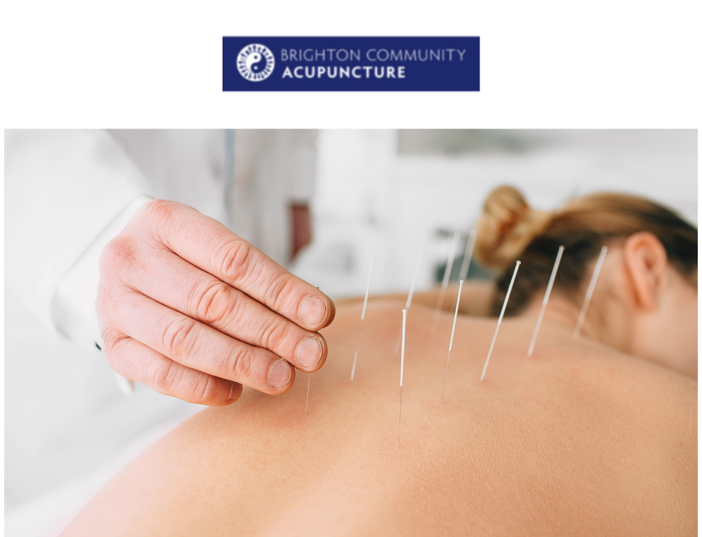 Brighton Community Acupuncture – Affordable Acupuncture