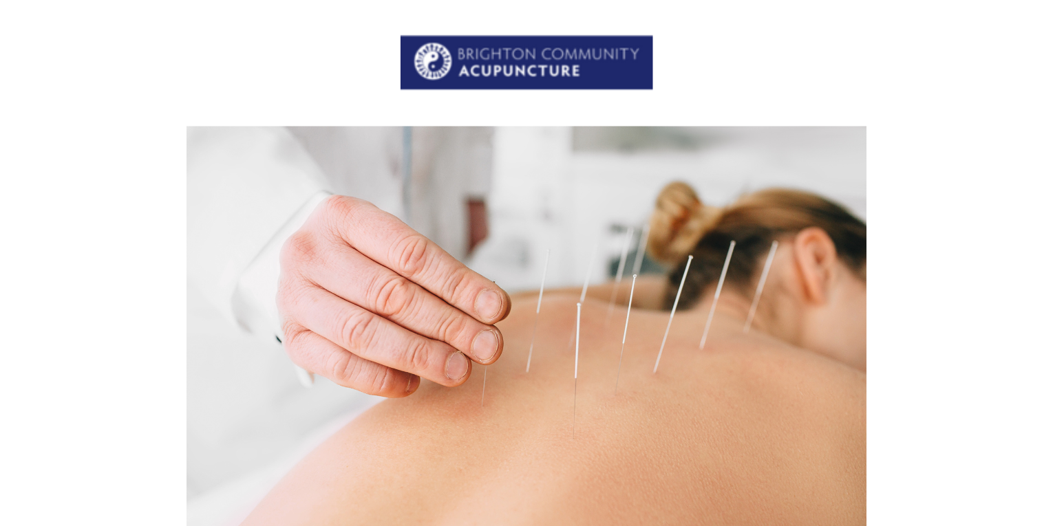 Brighton Community Acupuncture – Affordable Acupuncture